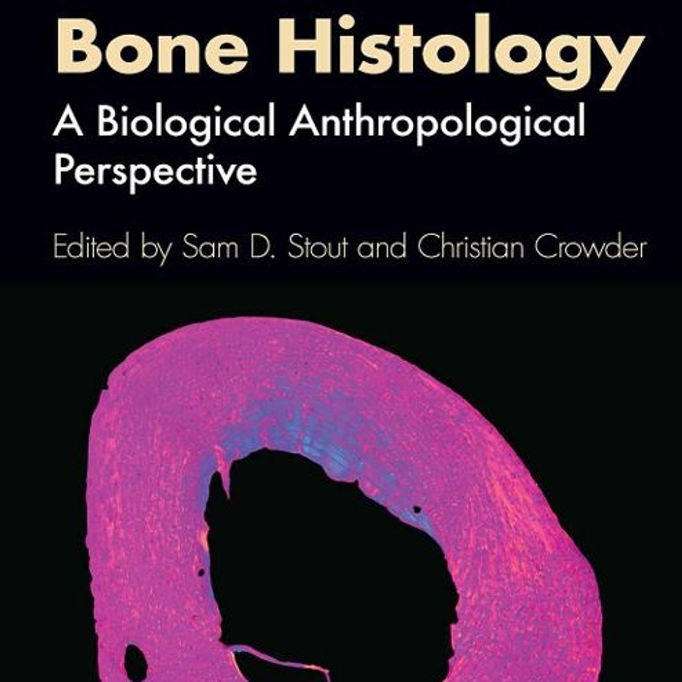 Bone Histology: A Biological Anthropological Perspective