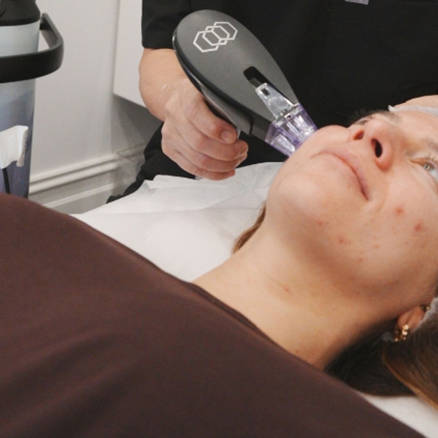 Morpheus8 for Scars Which Scar Types May Respond to Treatment episode artwork