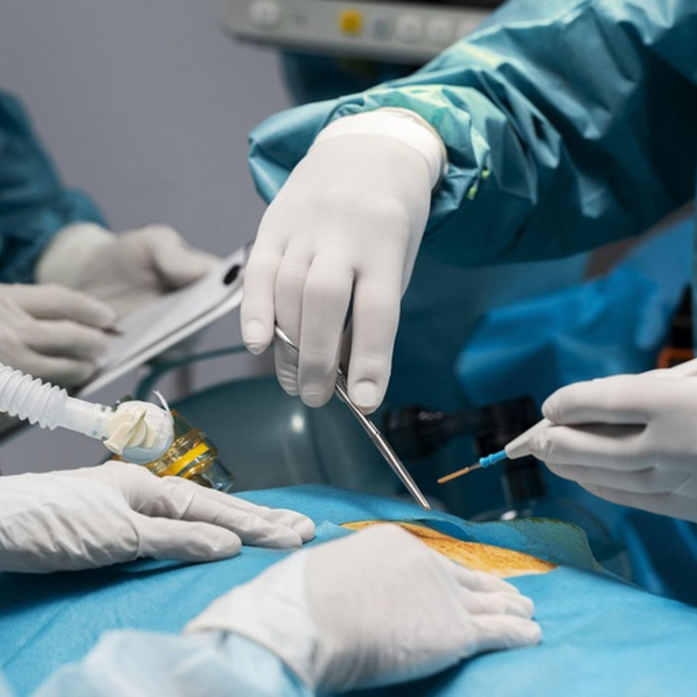 Serviço de Transplante de Medula Óssea do HUWC detém nível máximo