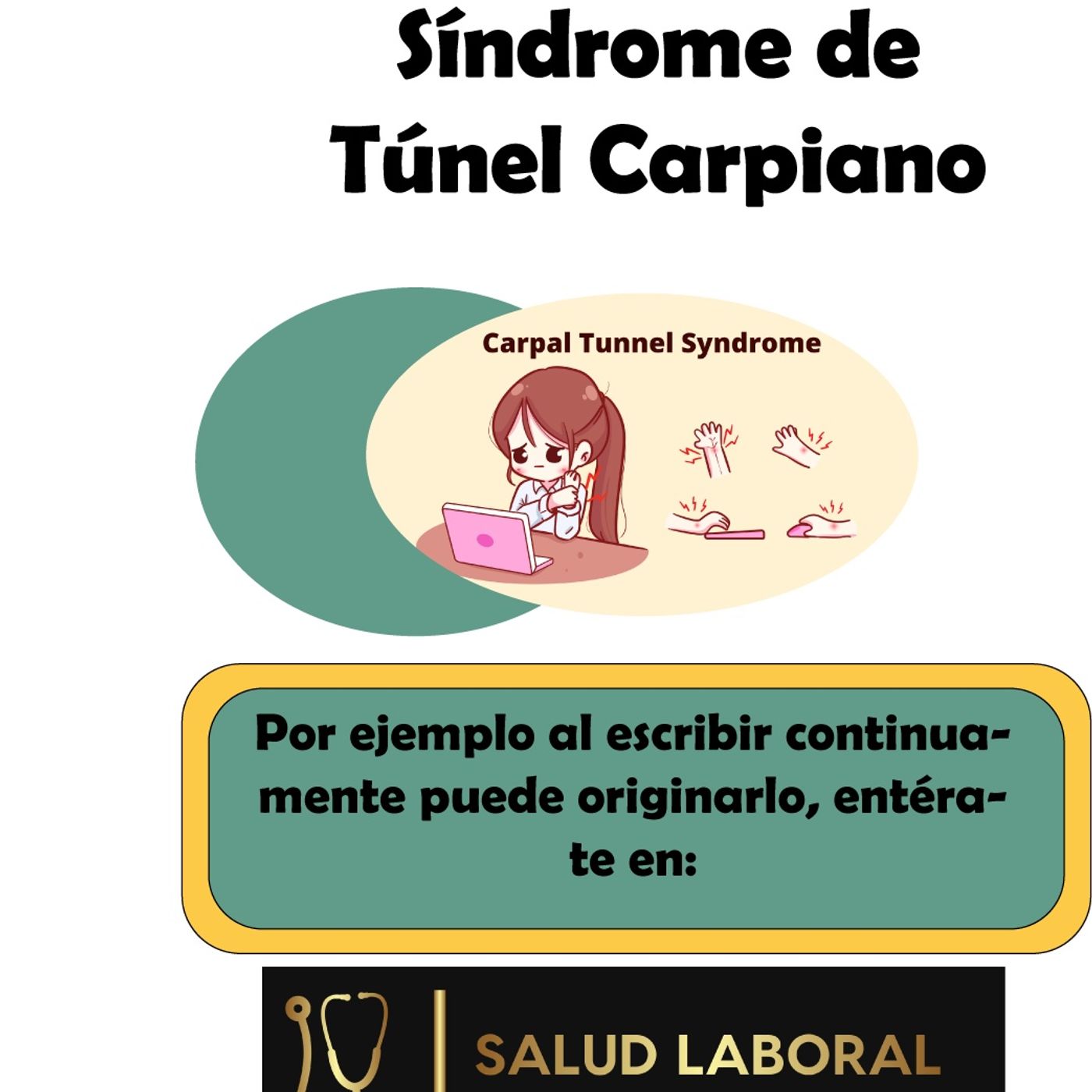 Síndrome De Túnel Carpiano By La Importancia De La Salud Y Seguridad ...