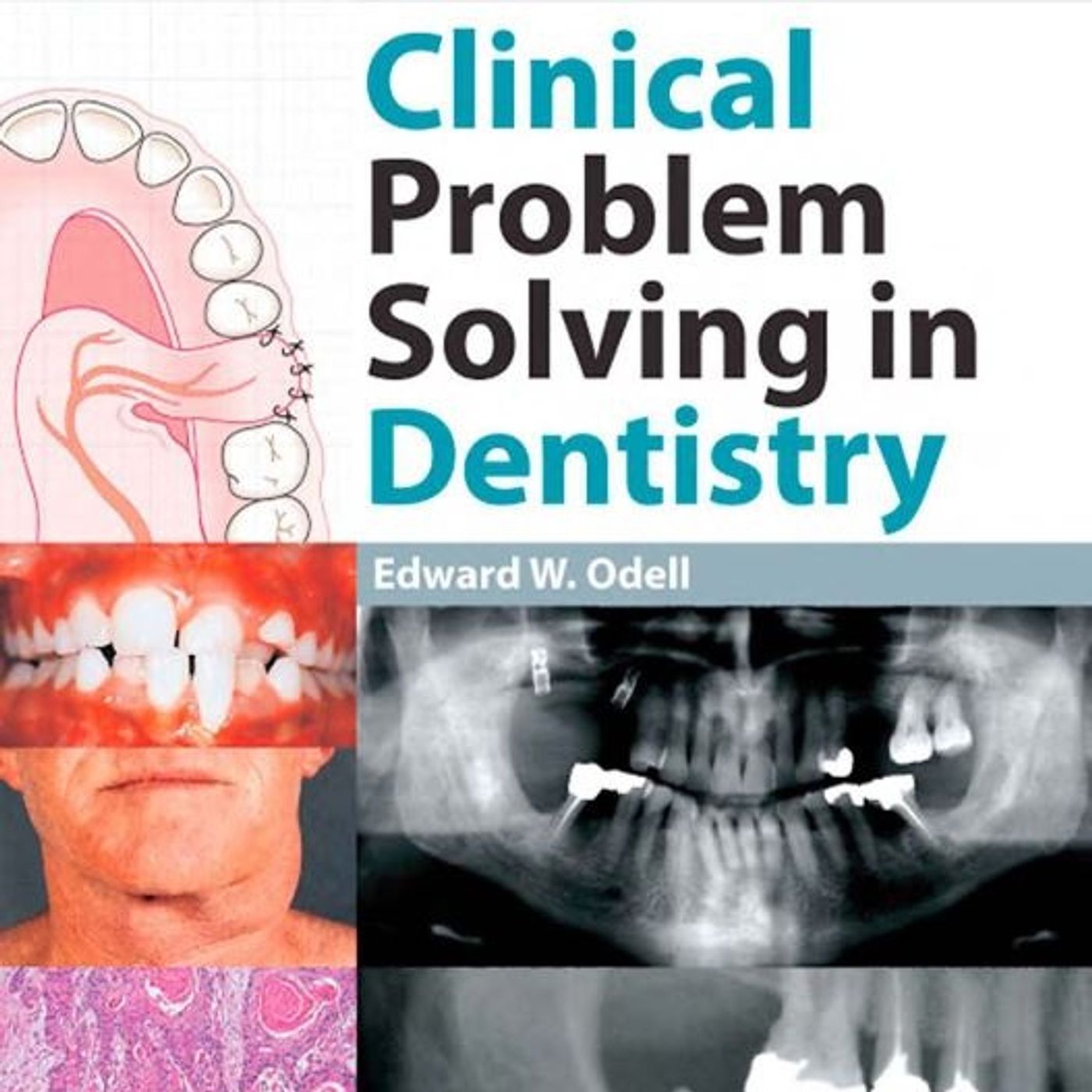 Clinical Problem Solving in Dentistry