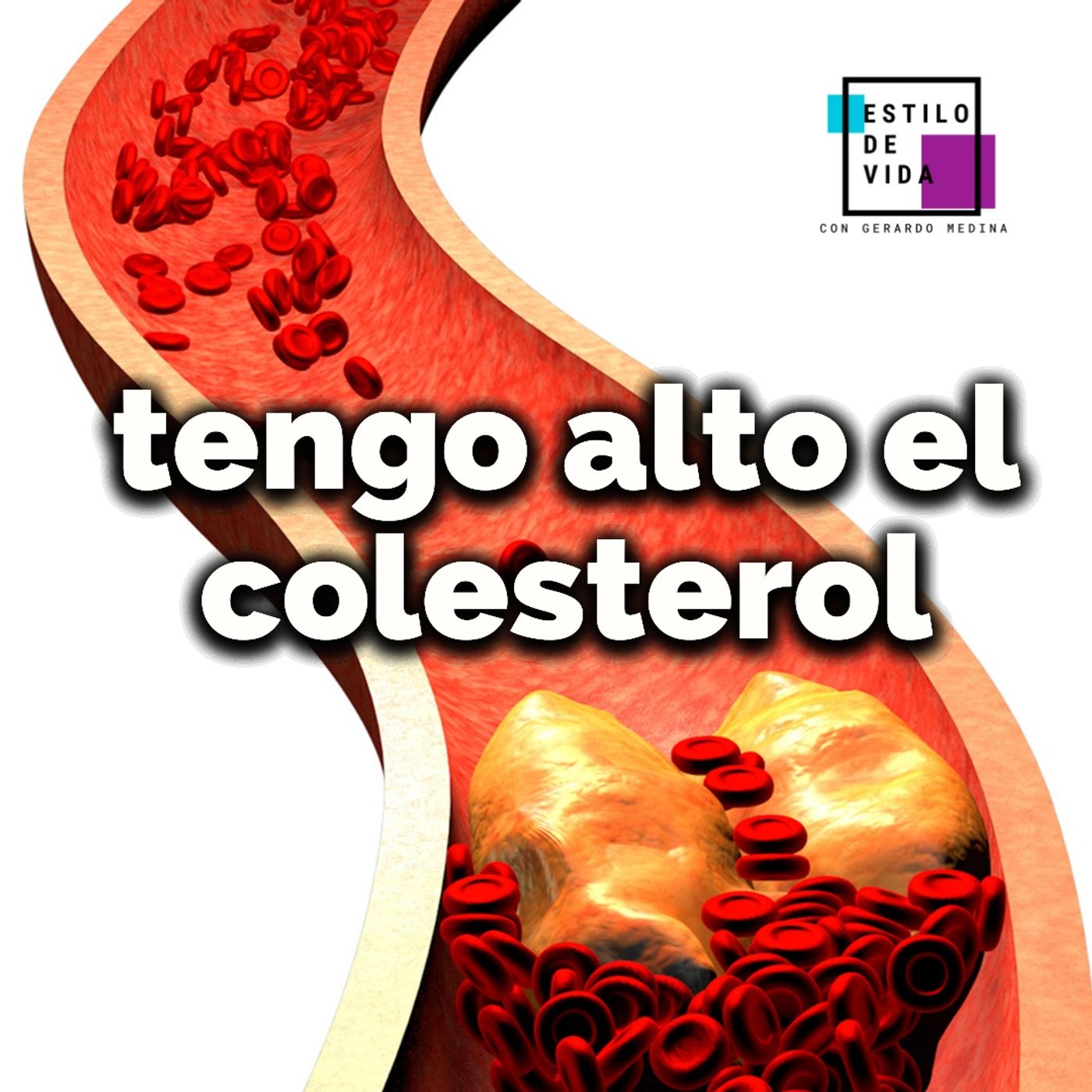 Tengo COLESTEROL alto 😱