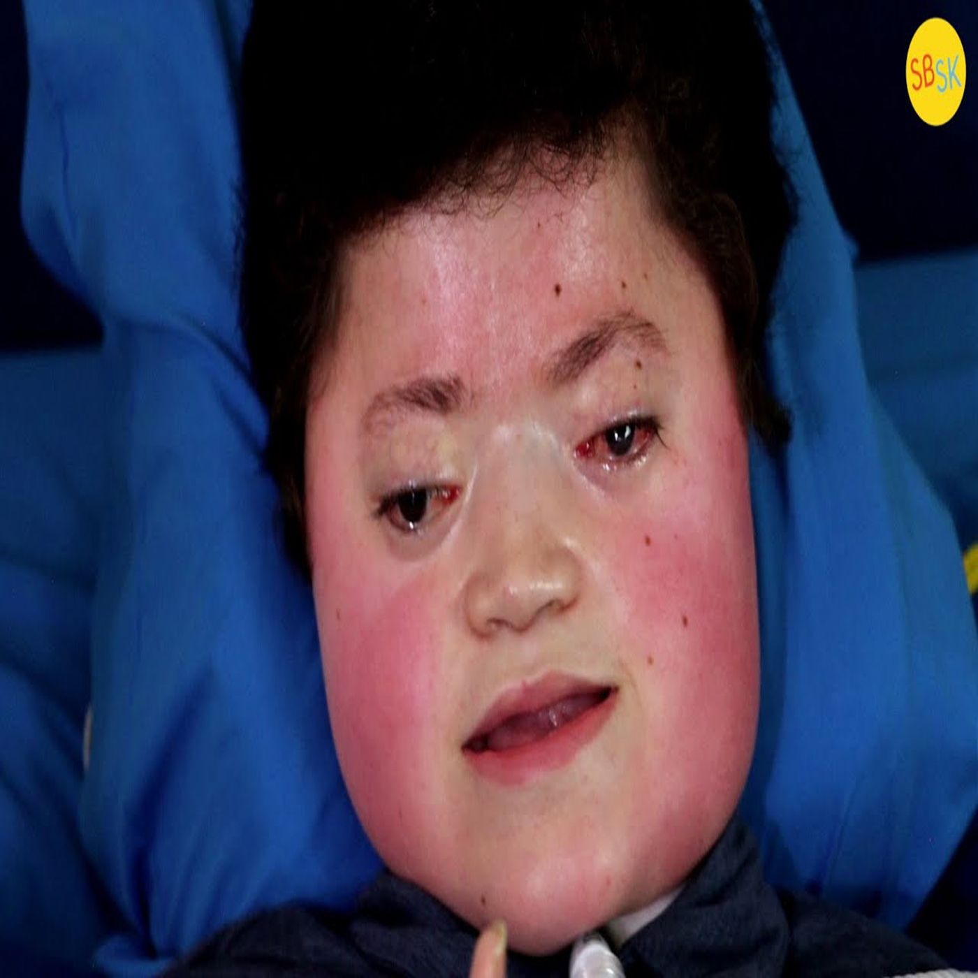 No Muscle Movement, Just Pure Love (Lincoln’s Story) No Muscle Movement, Just Pure Love (Lincoln’s Story)