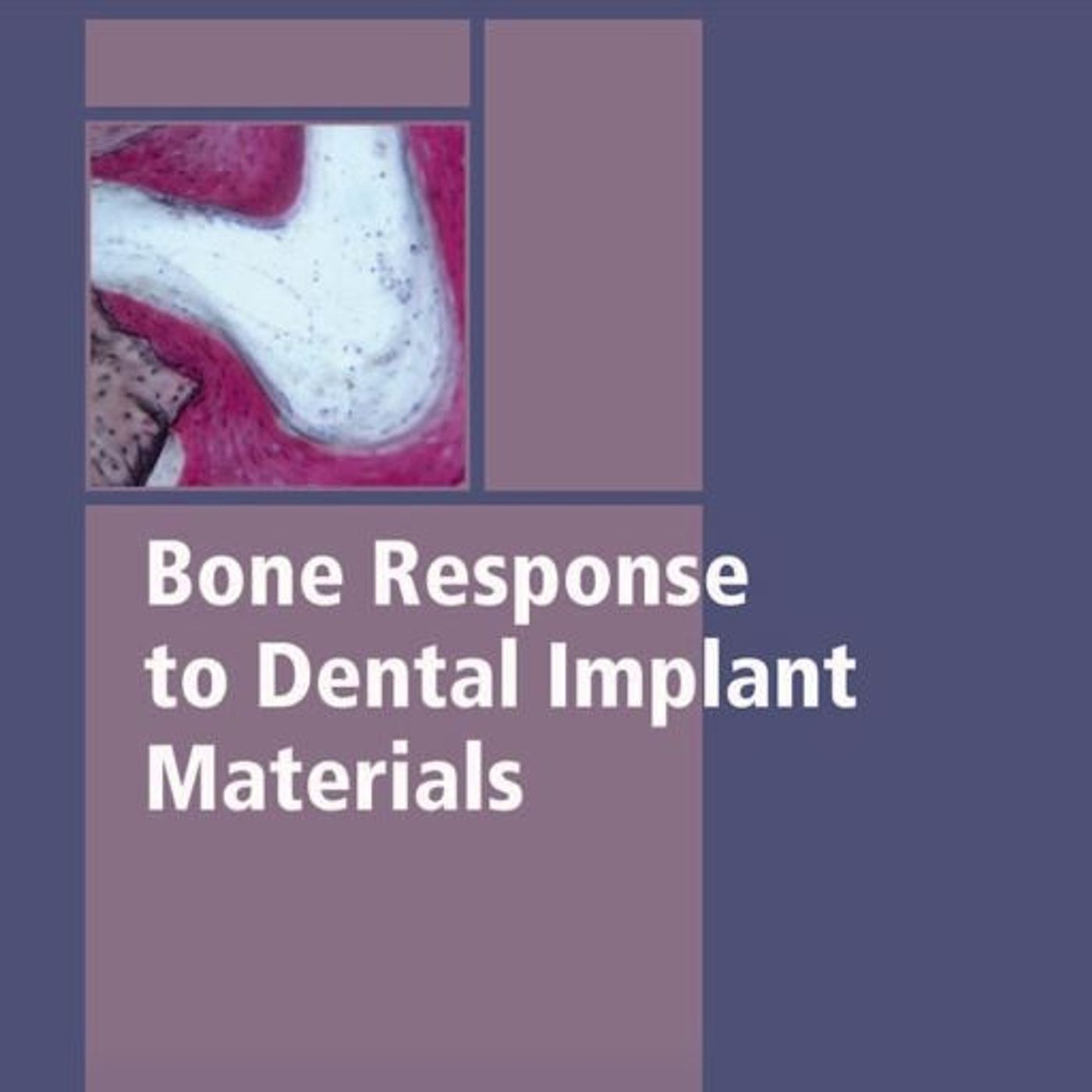 Bone Response to Dental Implant Materials