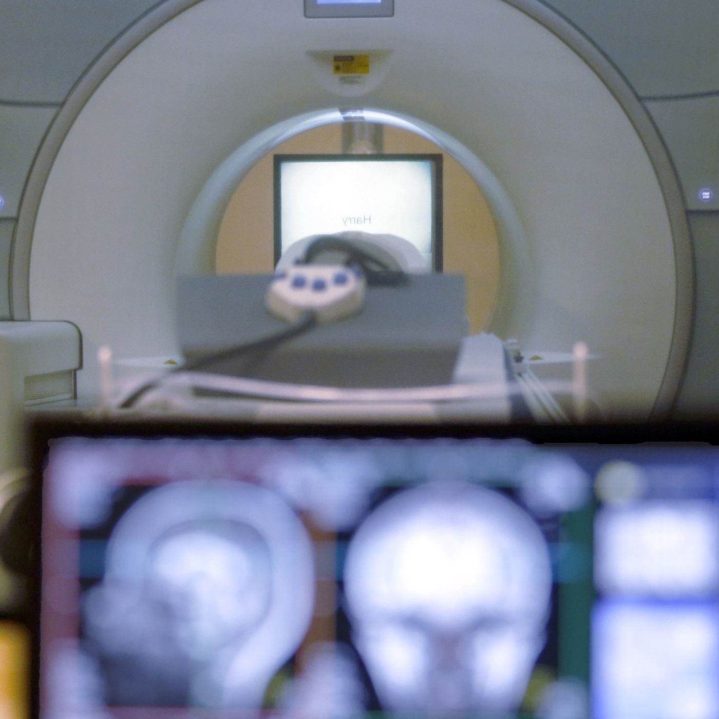 Patrick: 4 Ways To Stop A.I. From Rotting Your Brain