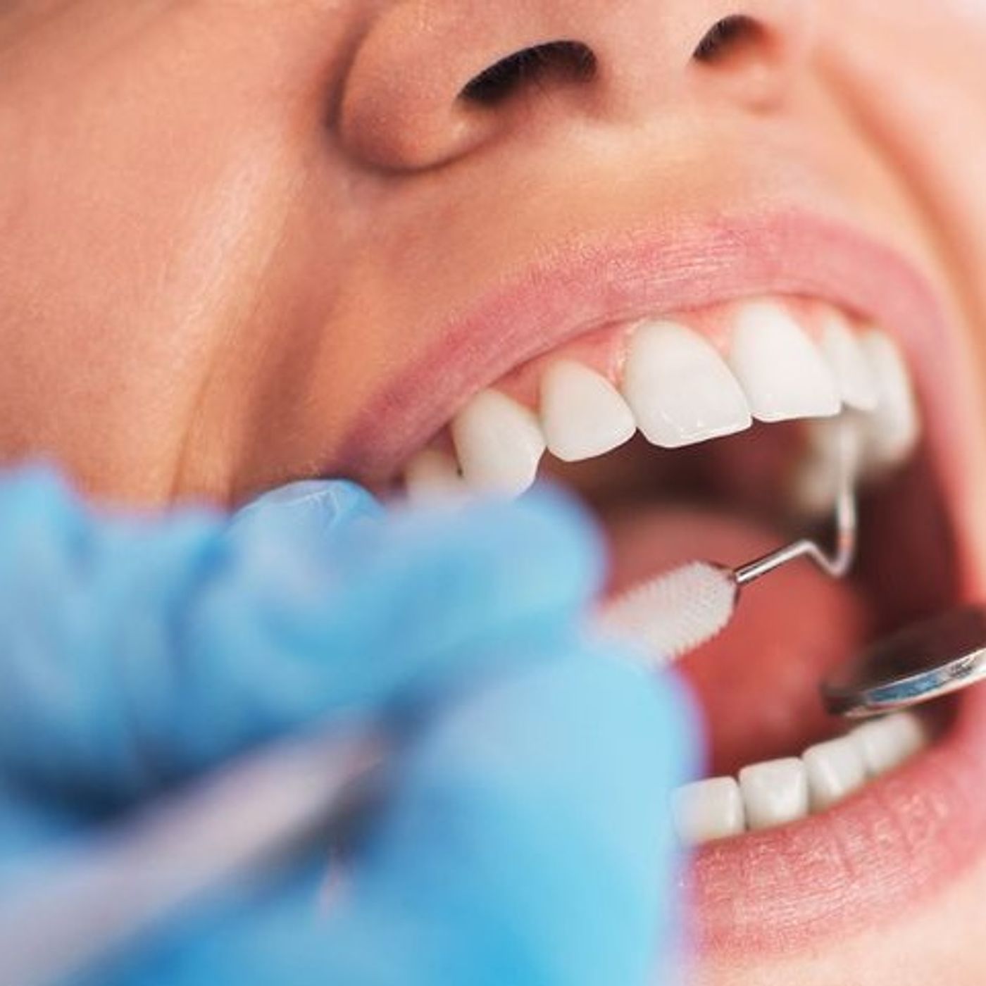 One in 10 England dentists stop offering NHS care, analysis suggests episode artwork