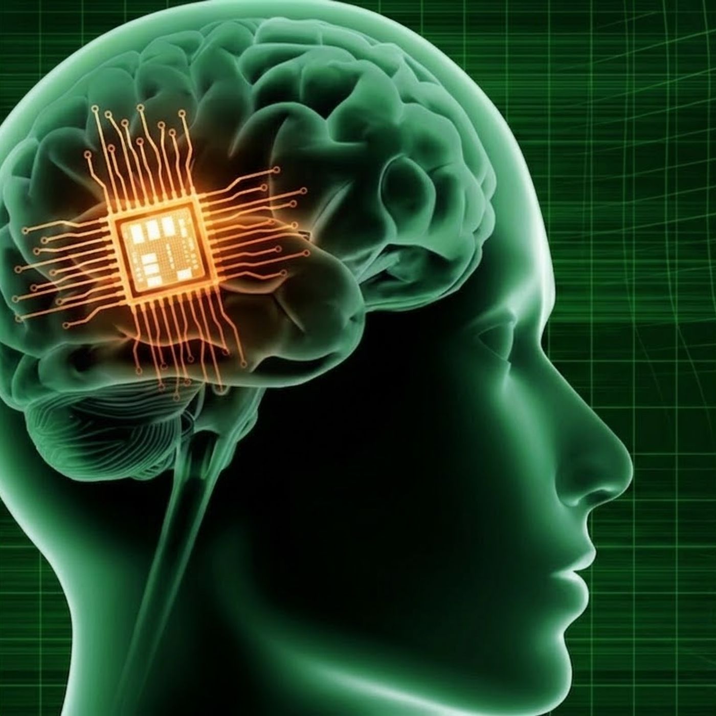 Ti faresti trapiantare un micro chip al cervello episode artwork
