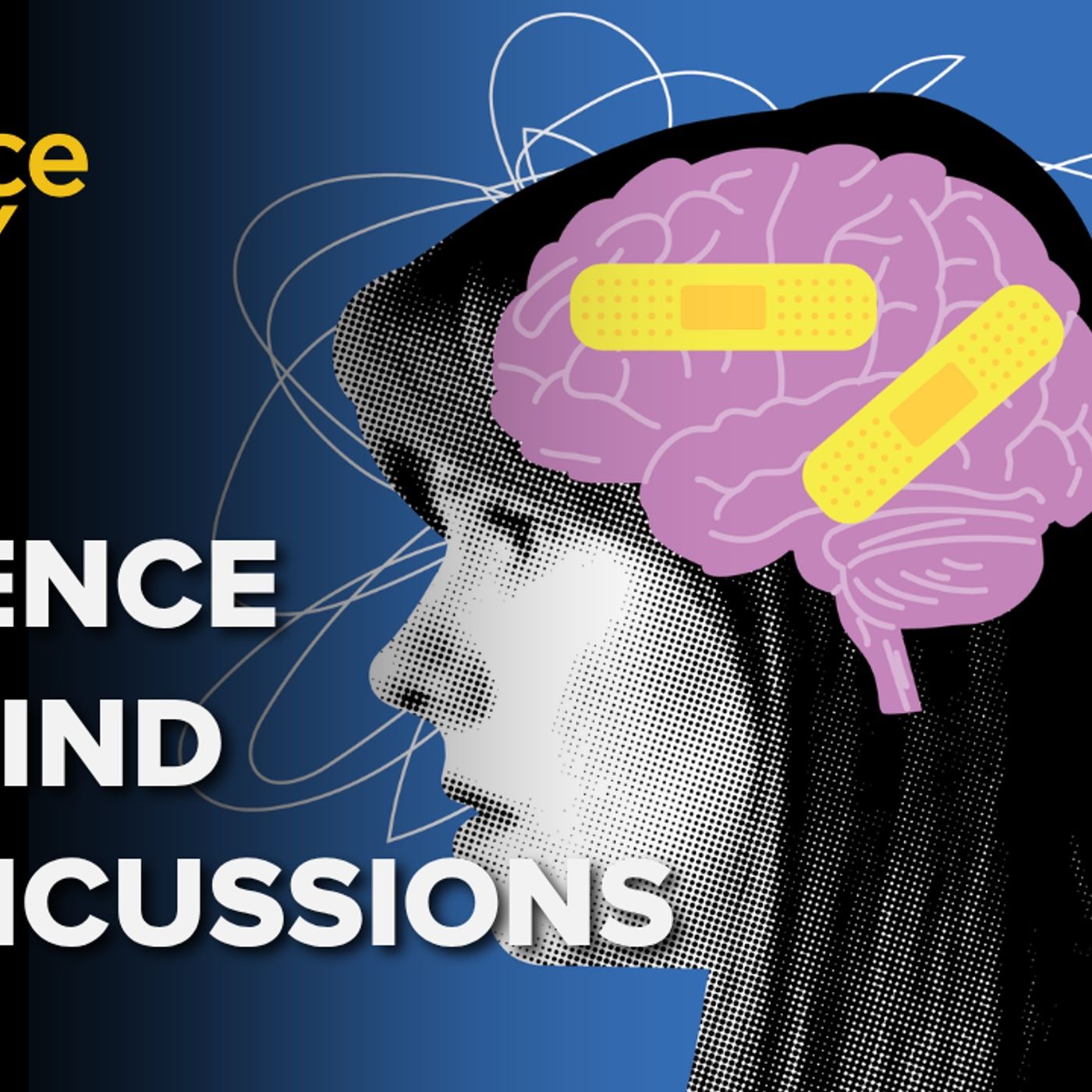 1403: How do concussions affect the brain?