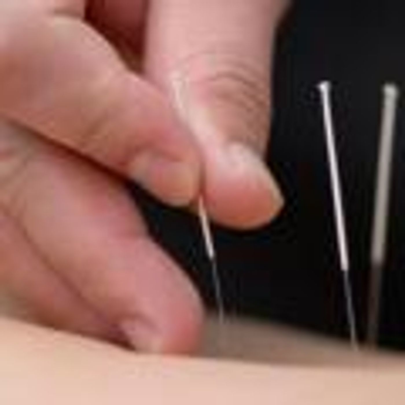 Light On Living with Lisa Berry: Lighten the Load of Life's Challenges: Pain Relief By Pin Pointing and Stimulating with Chiropractor and Ac episode artwork