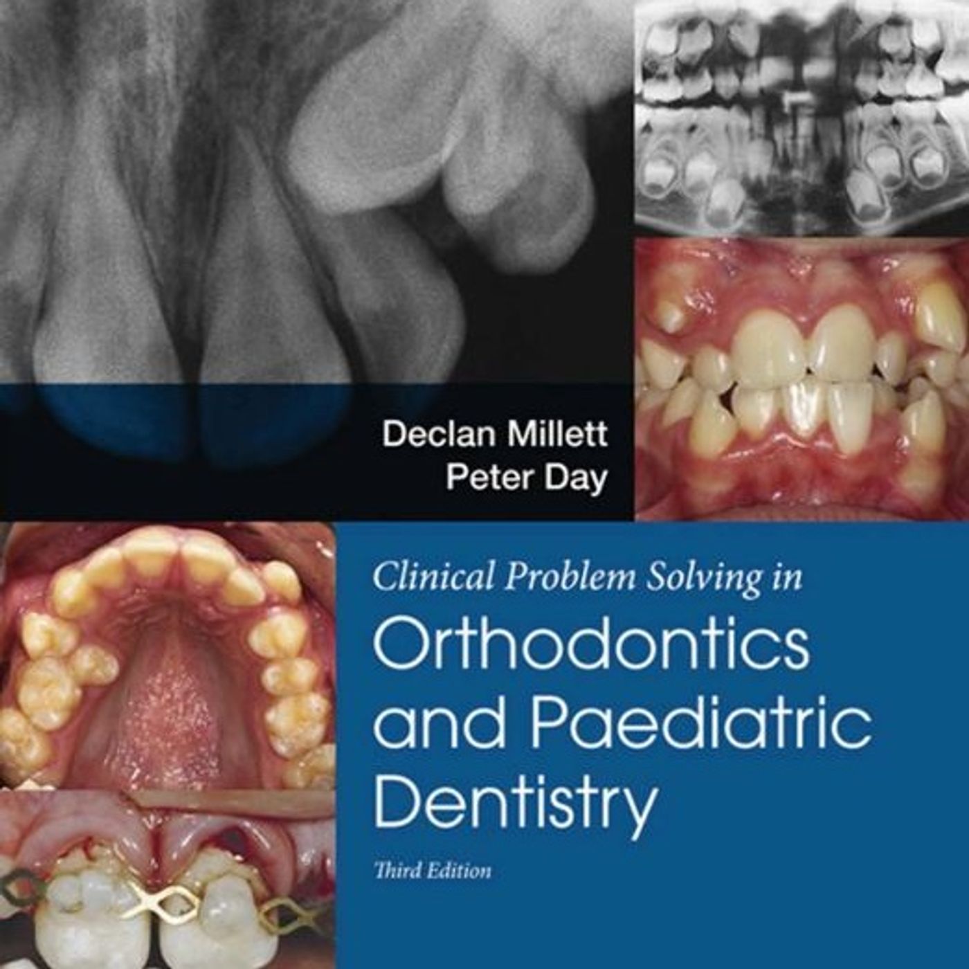 Orthodontics & Paediatric Dentistry
