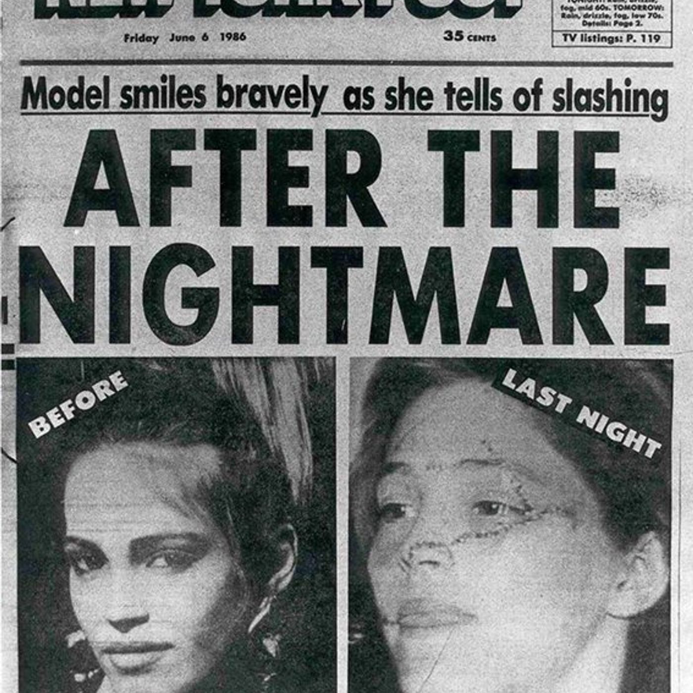 The Slashing of NYC Model Marla Hanson (1986) & NON-Creepy Surgical Charities - podcast episode cover