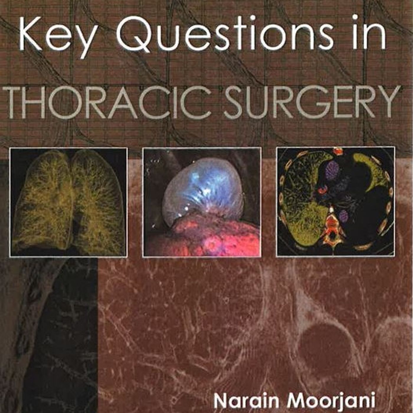 Key Questions in Thoracic Surgery
