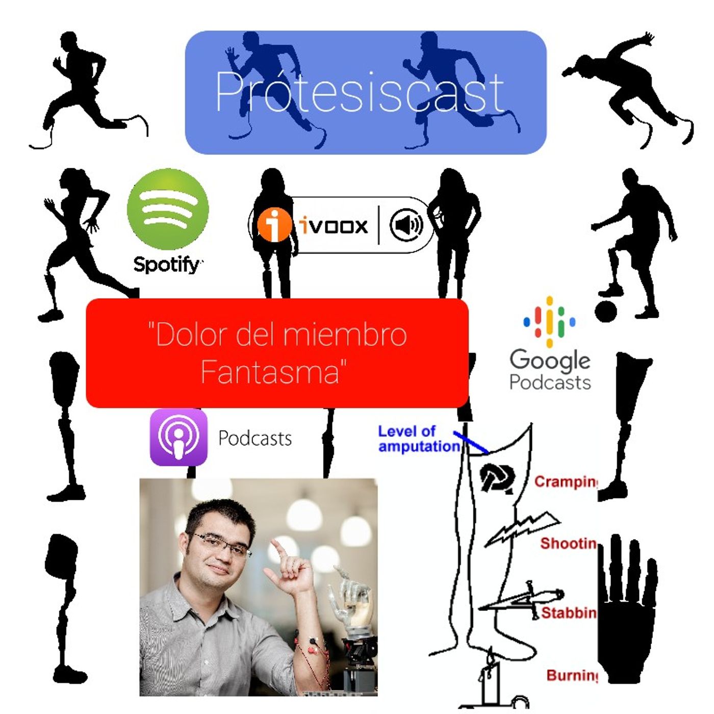 protesiscast