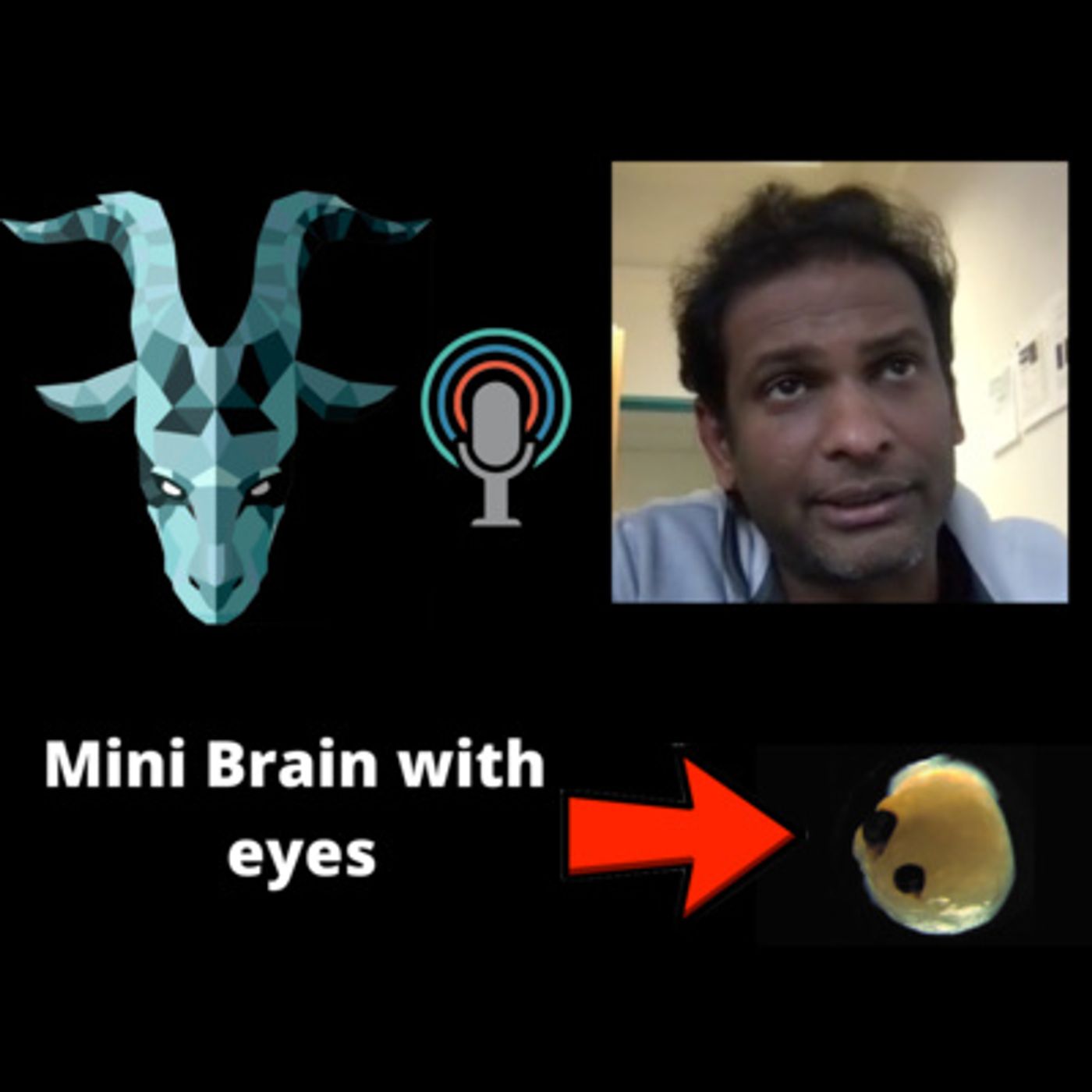 Interviewing the scientist who grew a mini brain with eyes (ft. Dr. Jay Gopalakrishnan)