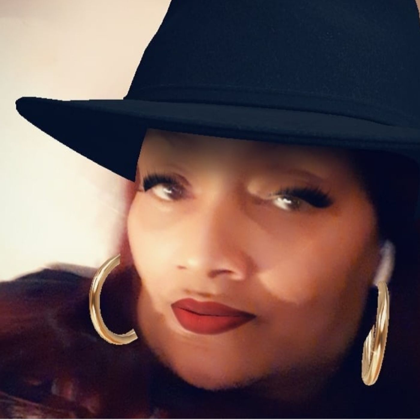 Susan Hendrix My Story Living With Lupus
