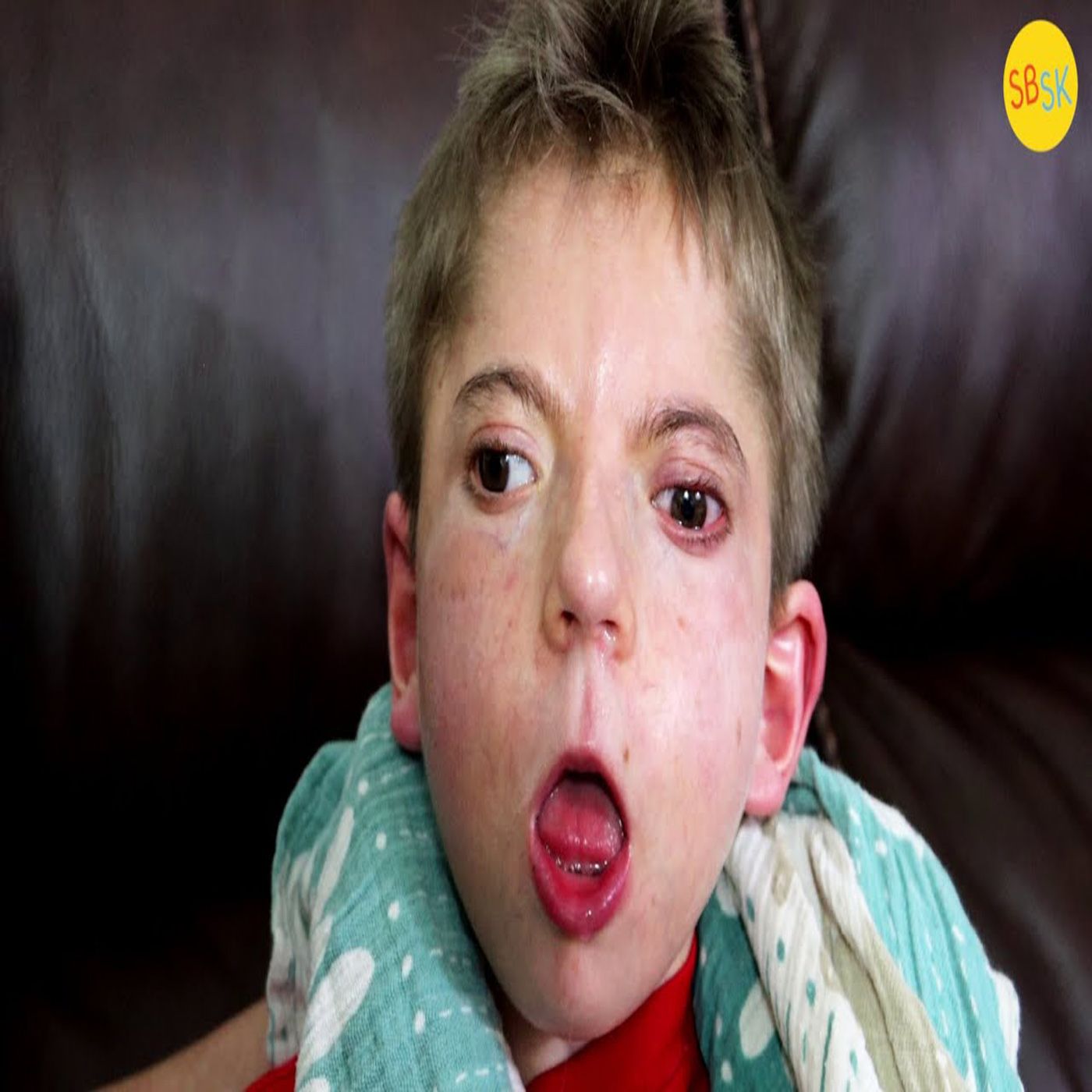 Born Without a Pivotal Part of the Brain (Agenesis of the Corpus Callosum) Born Without a Pivotal Part of the Brain (Agenesis of the Corpus Callosum)