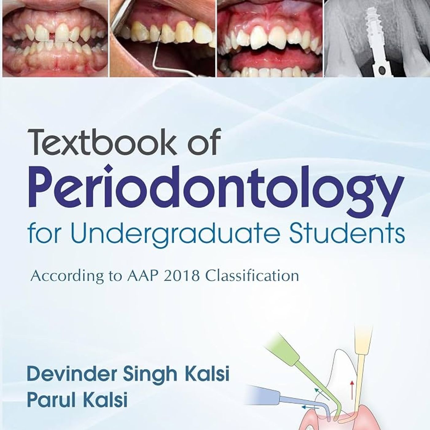 Textbook of Periodontology for Undergraduate Students