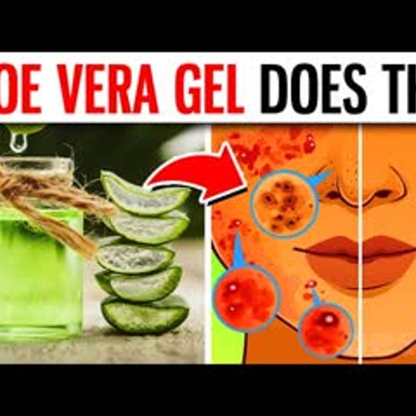 10 POWERFUL Benefits Of Aloe Vera Gel episode artwork