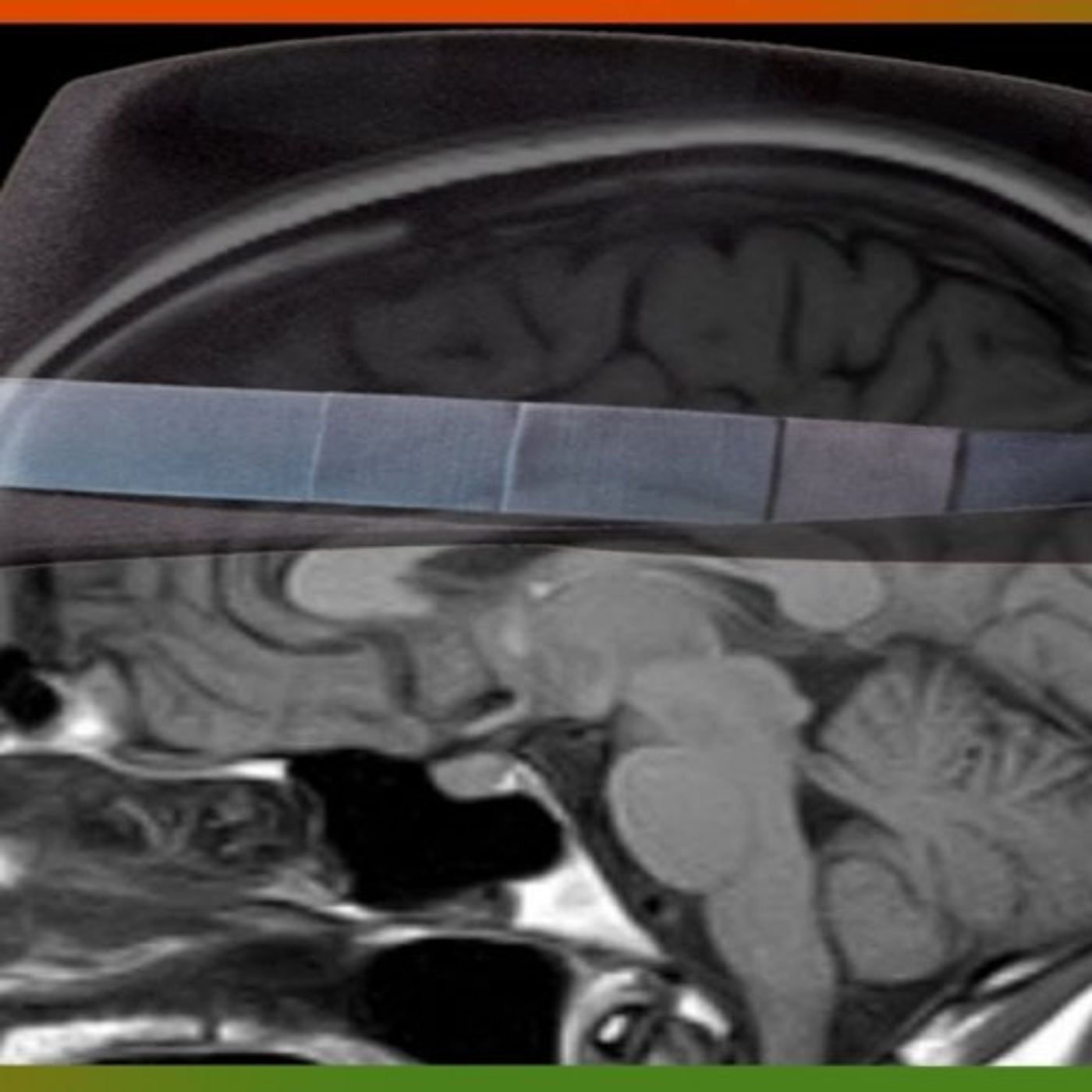 ReddXperiments: A Man Didn't Shower For 30 Days. This Is What Happened To His Brain.