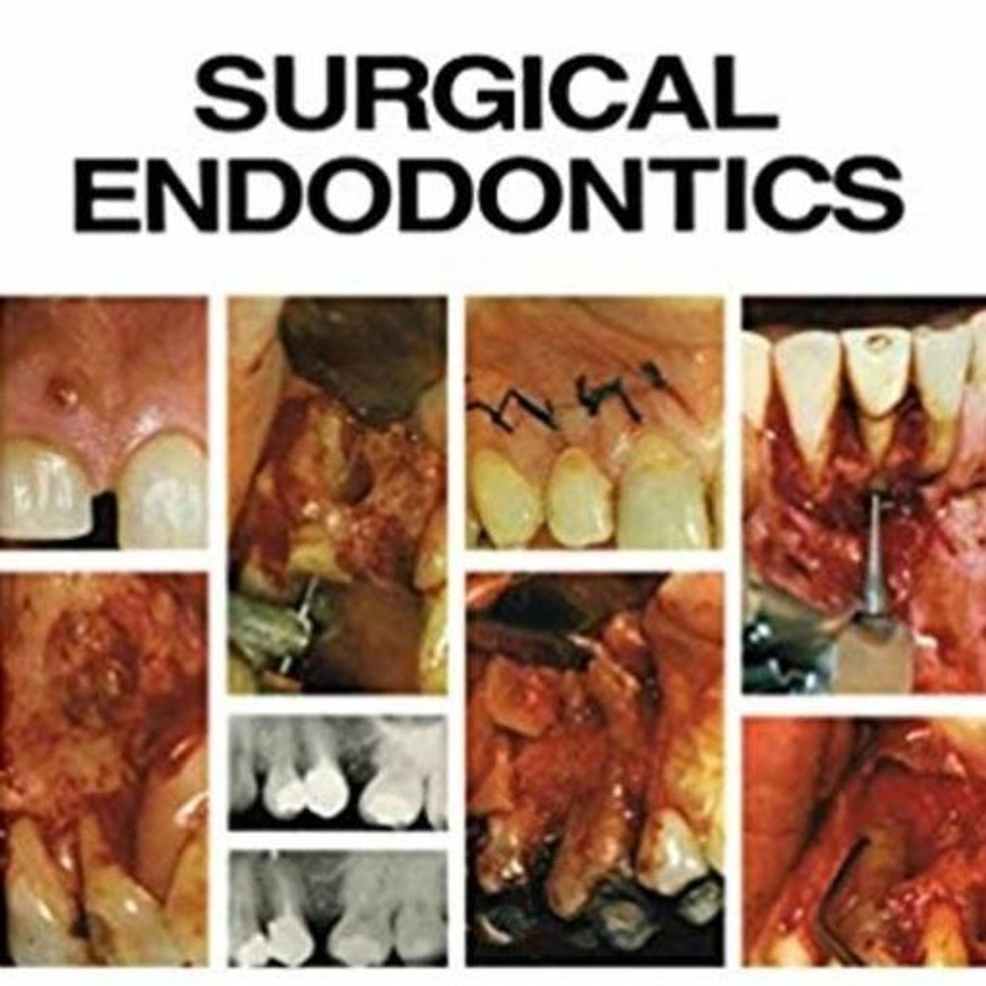 Surgical Endodontics: A Colour Manual