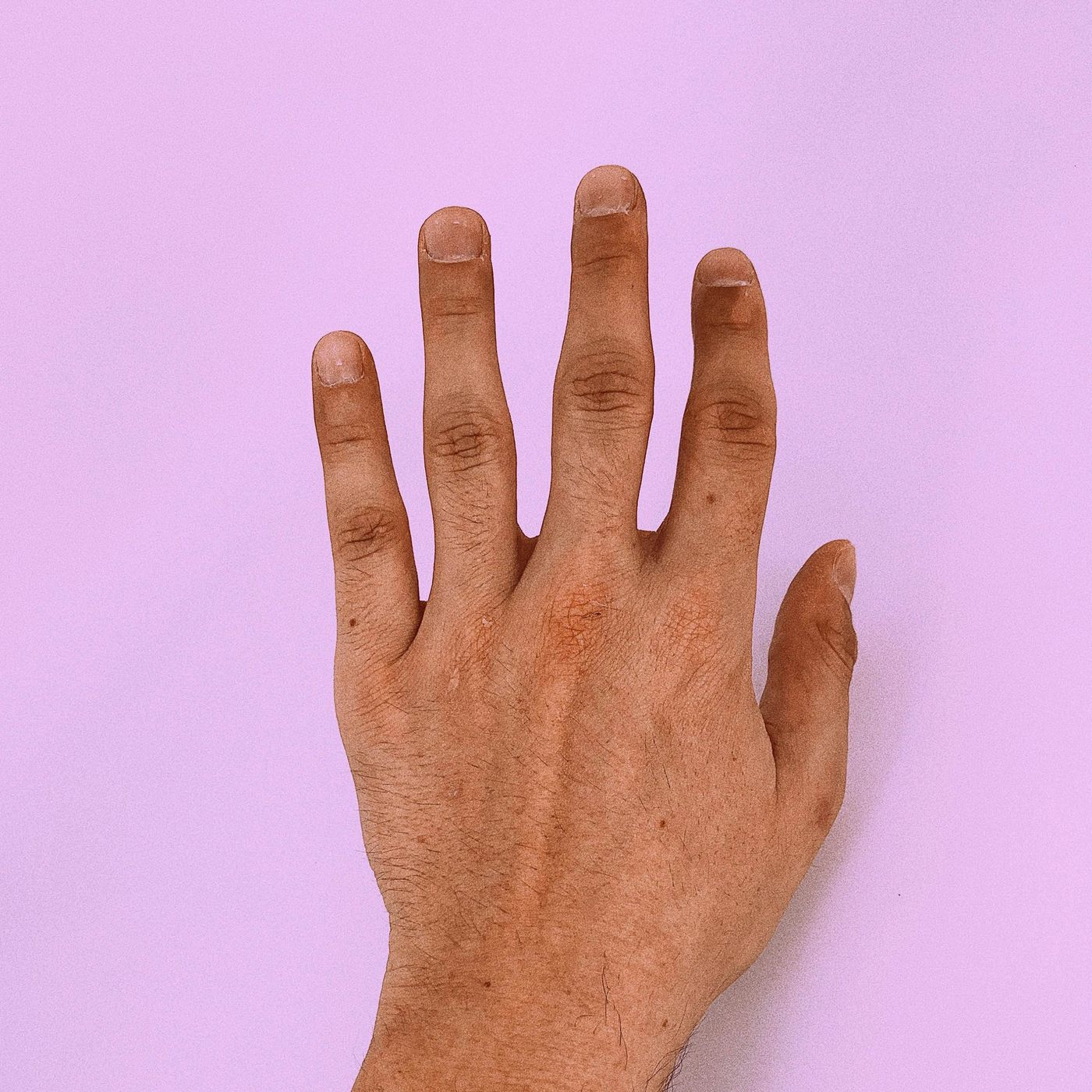 The Hidden Health Clues in Your Nails
