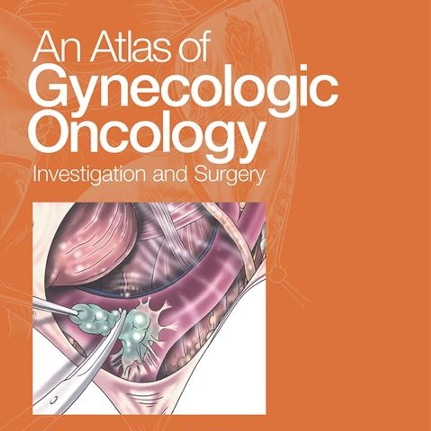 An Atlas of Gynecologic Oncology: Investigation and Surgery