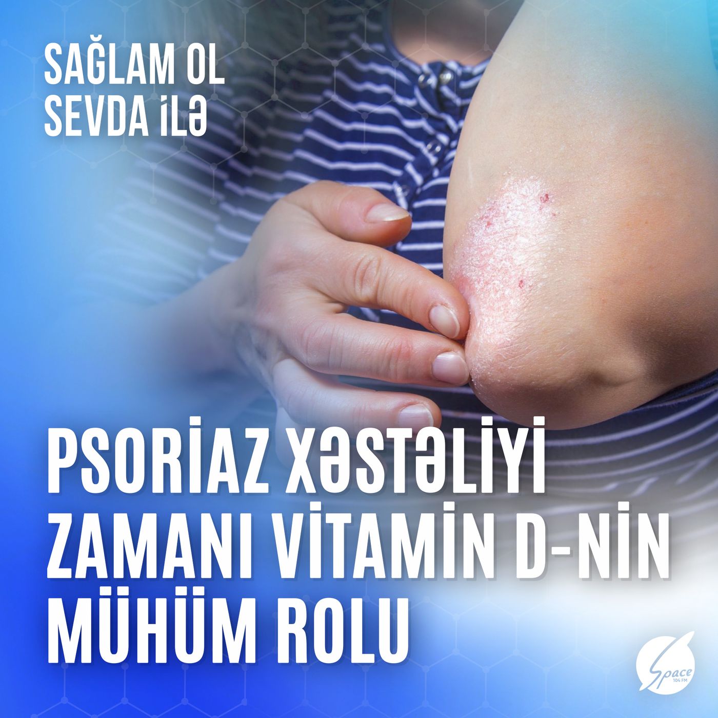 Sağlam ol Sevda ilə