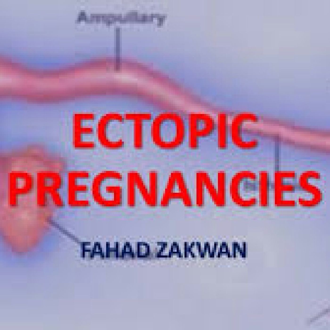 Ectopic Pregnancies Can Be Deadly! episode artwork