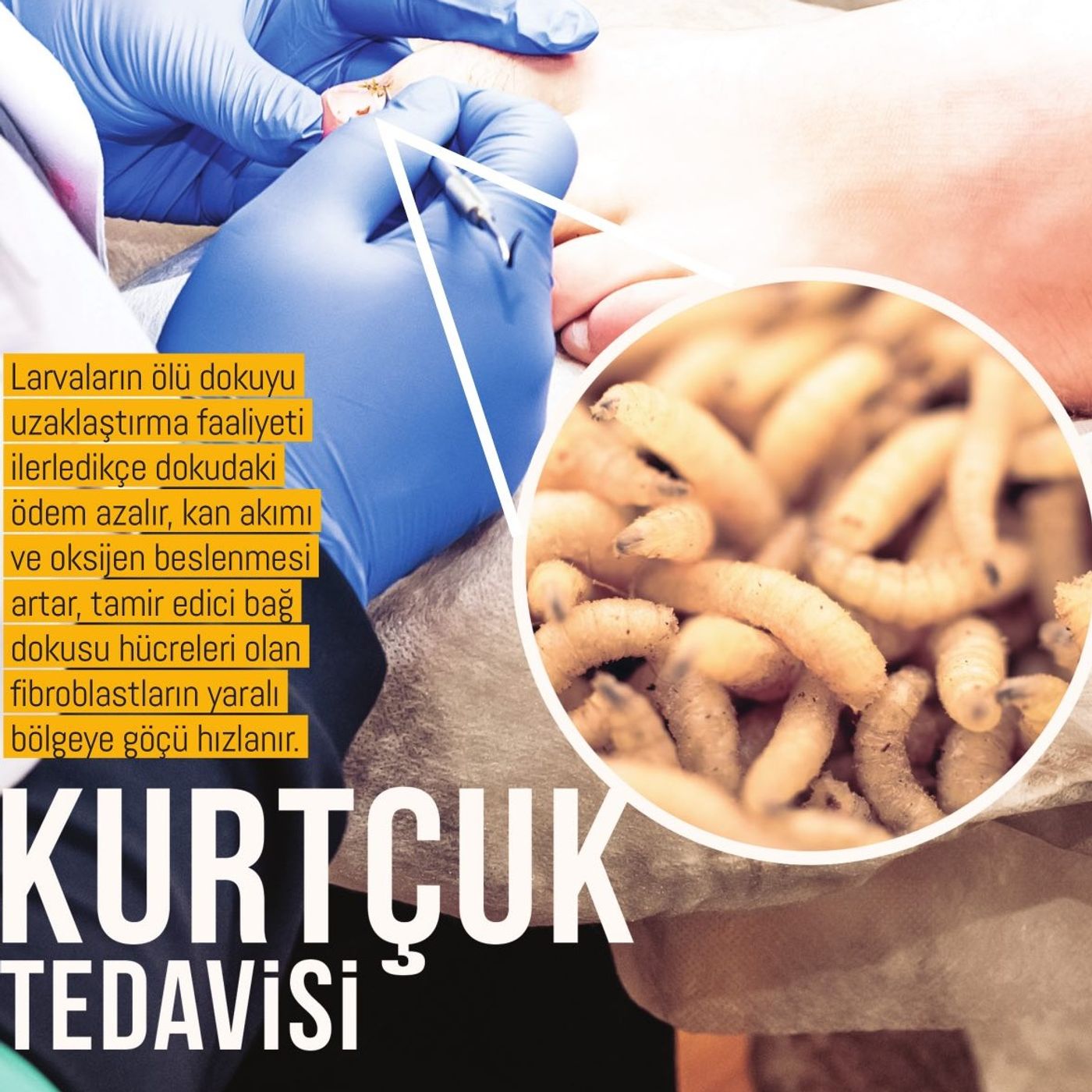Kurtçuk Tedavisi episode artwork