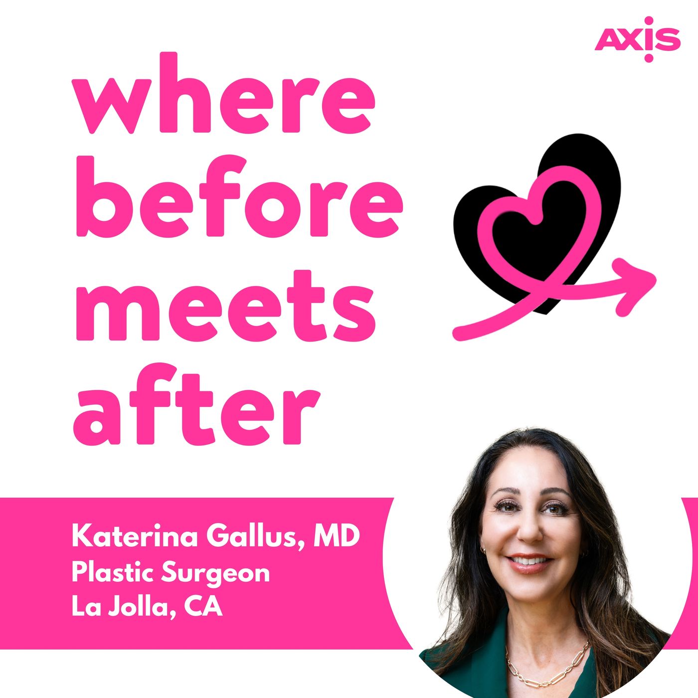 How much do breast implants cost in San Diego? [Katerina Gallus, MD, San Diego]