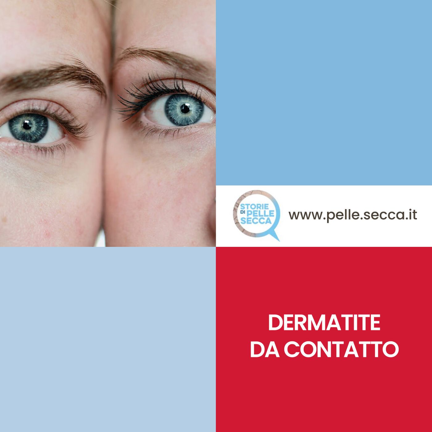 Storie di Pelle Secca