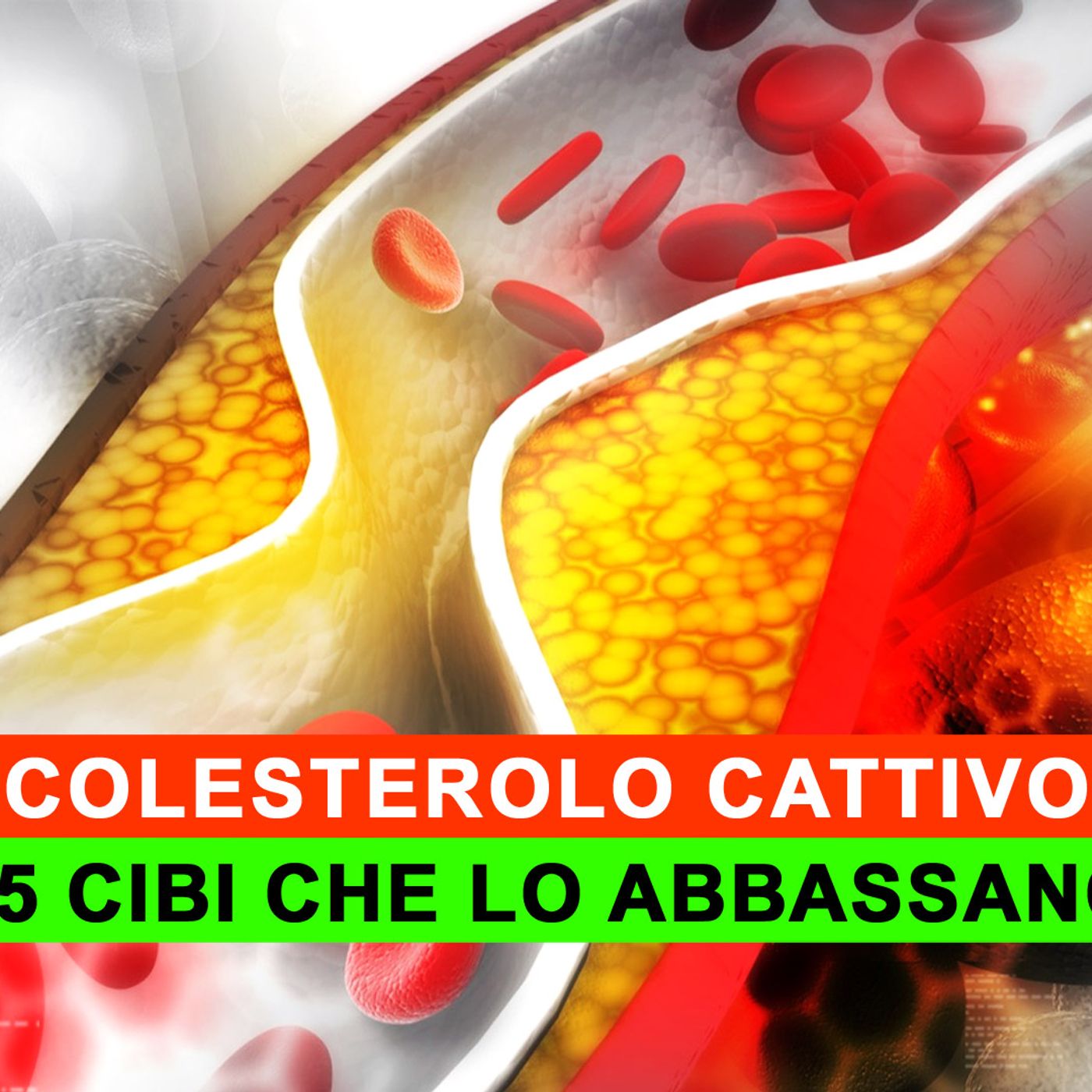 Colesterolo Cattivo: I 5 Cibi Che Lo Abbassano! episode artwork