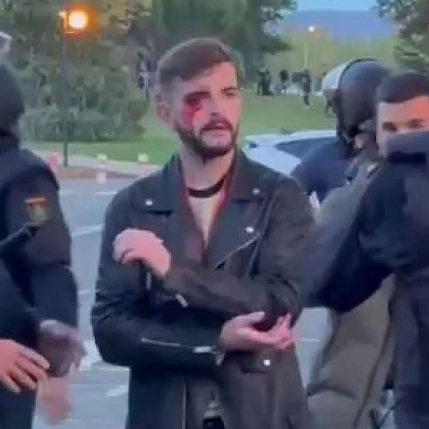 Tertulia La Trinchera. La izquierda defiende las palizas abertzales