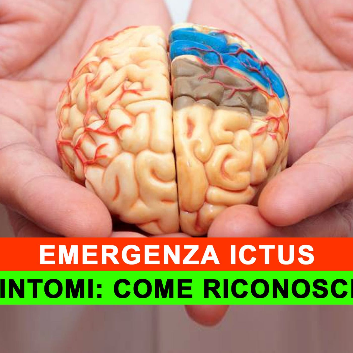 Emergenza Ictus: Come Riconoscere I 9 Sintomi! episode artwork