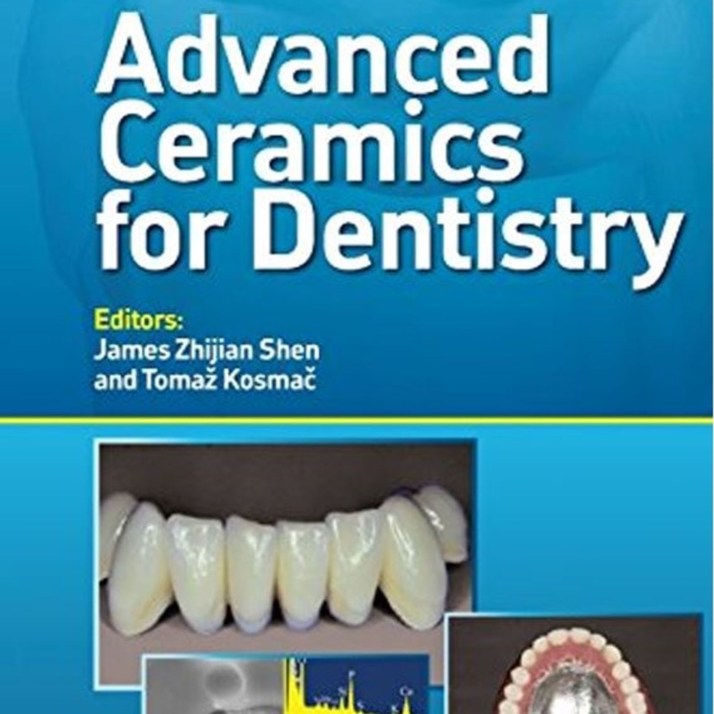 Advanced Ceramics for Dentistry