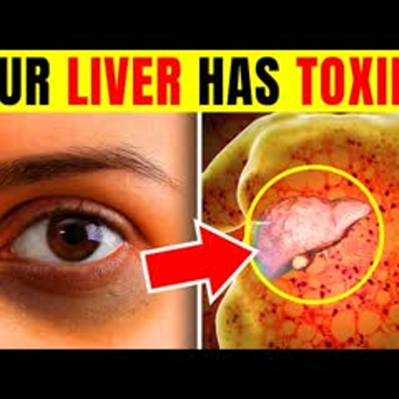 10 Warning Signs Your Liver Is Overloaded With TOXINS episode artwork