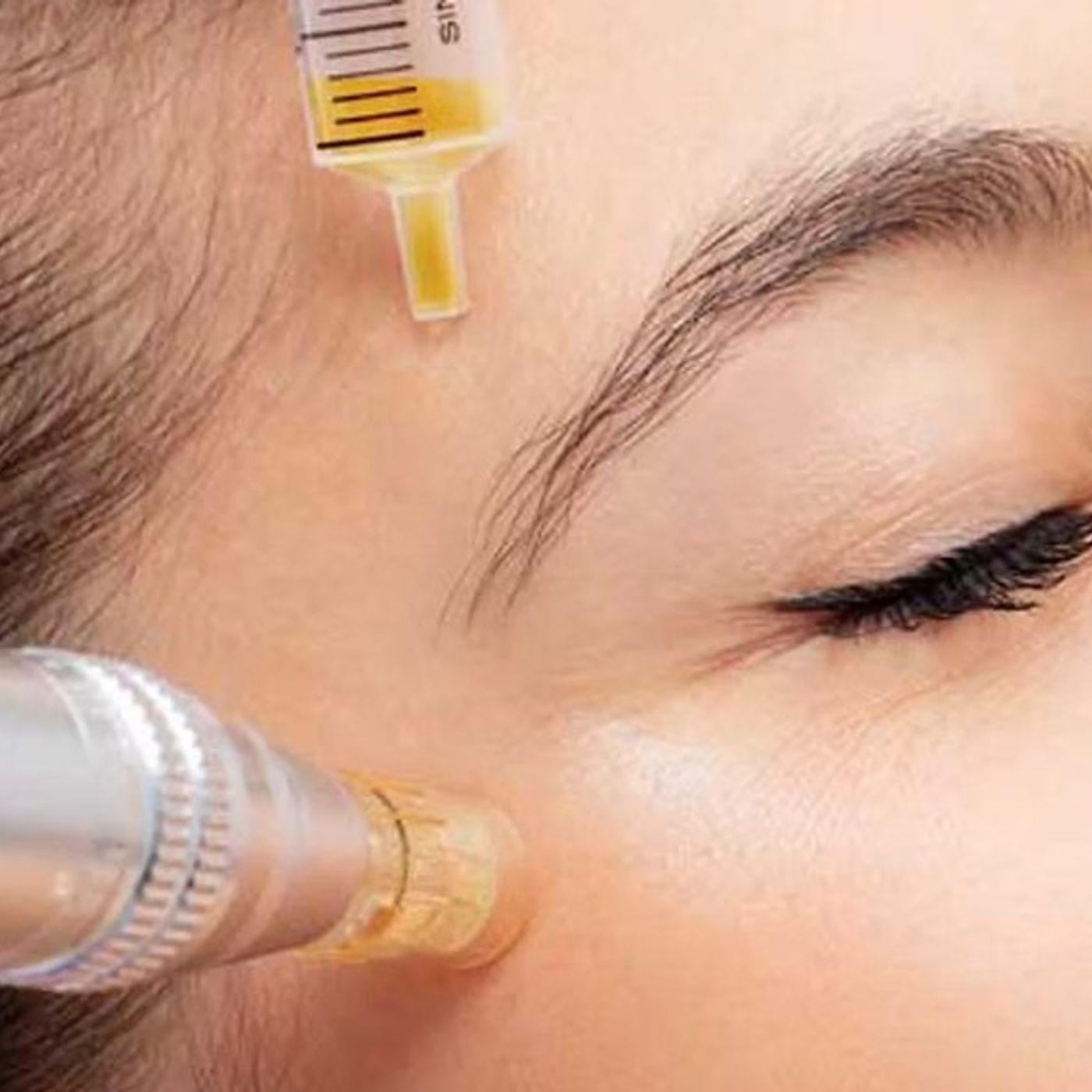 PRP With Microneedling Dallas Texas podcast artwork