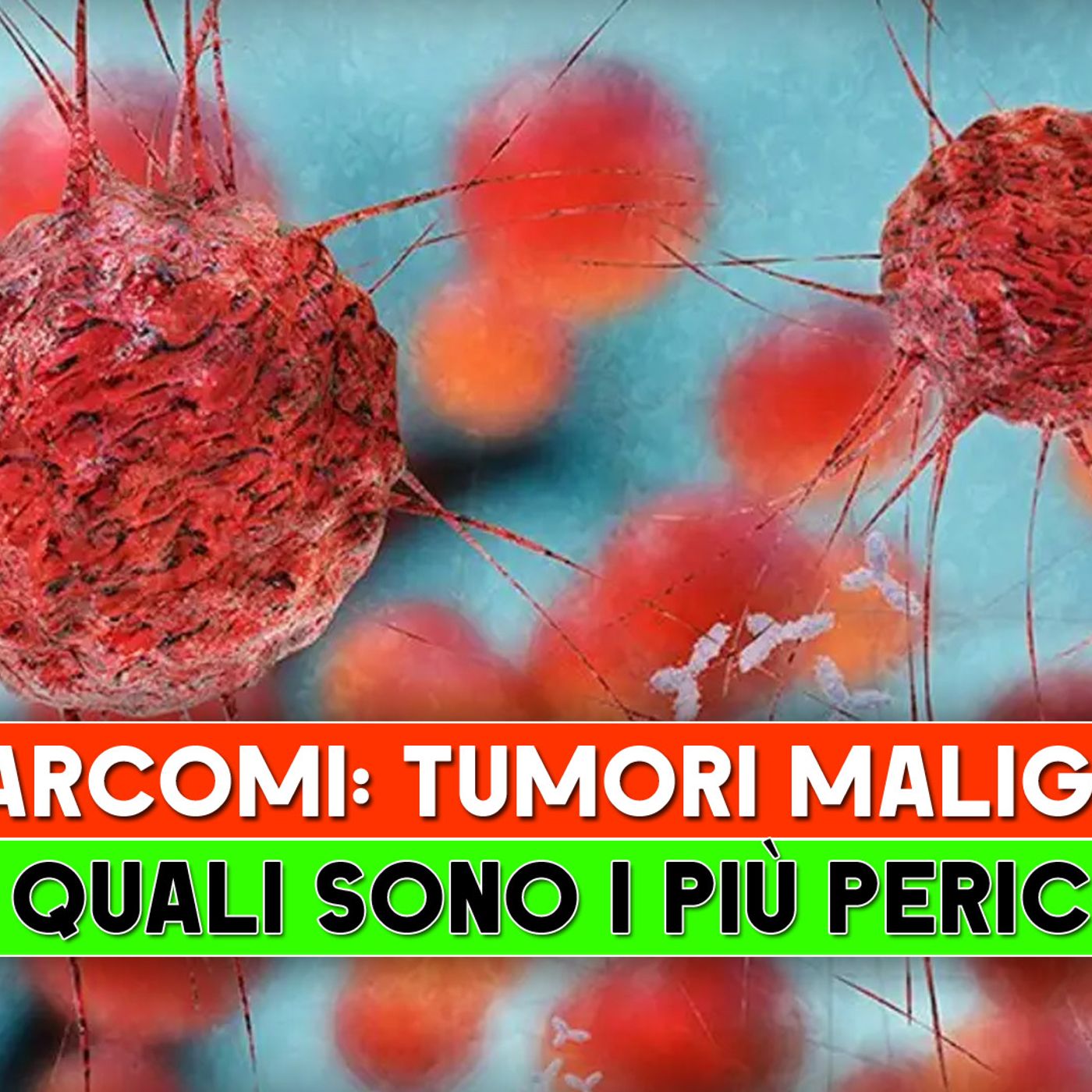 Sarcomi, Tumori Maligni: Ecco Quali Sono I Più Pericolosi! episode artwork