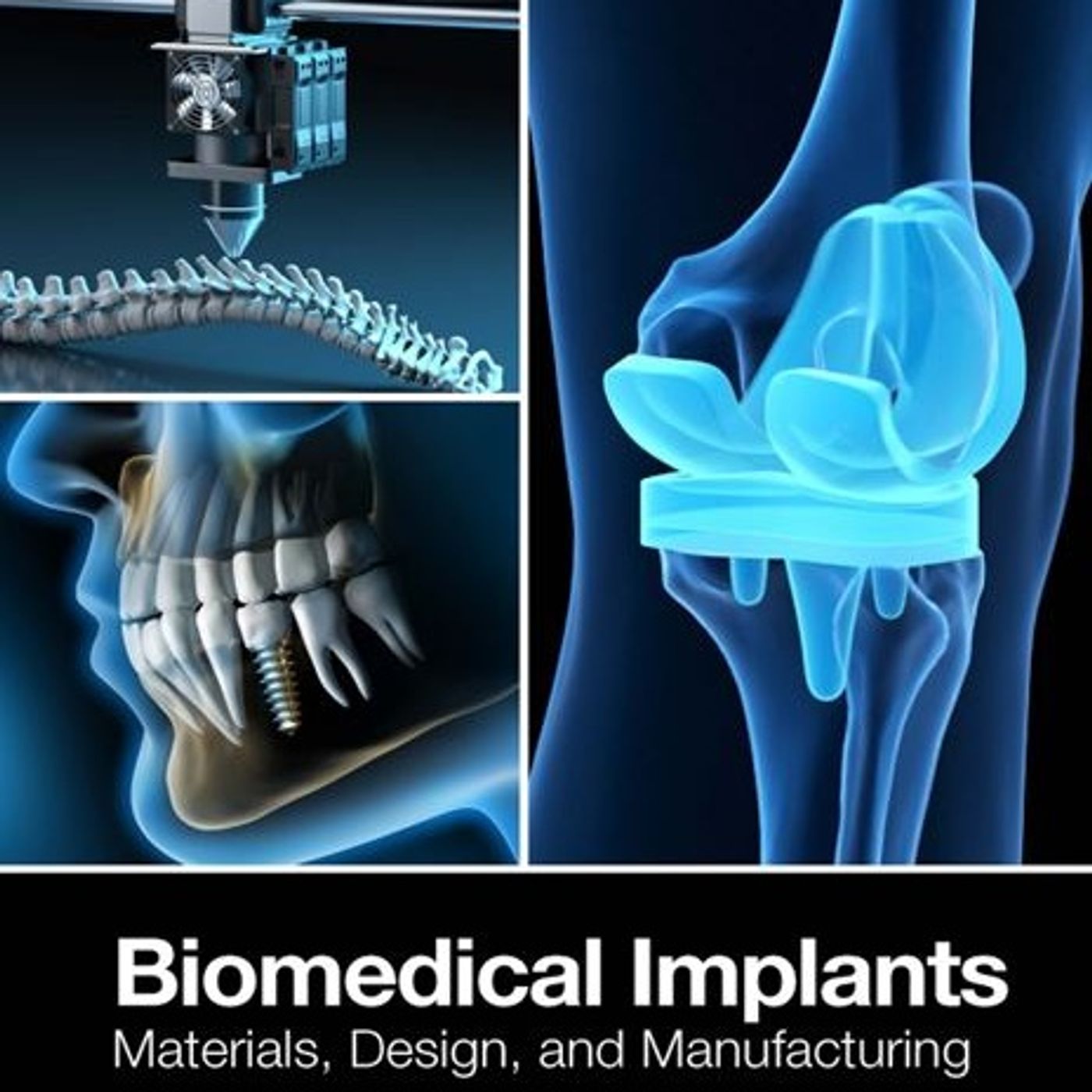 Biomedical Implants: Materials, Design, and Manufacturing