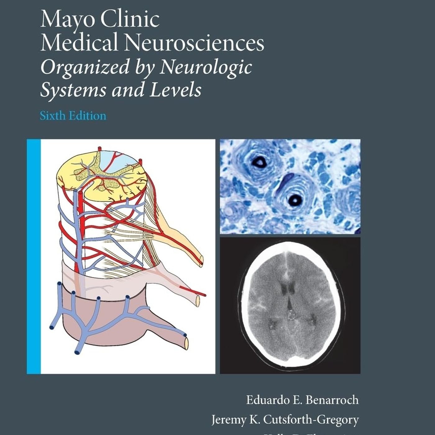 Mayo Clinic Medical Neurosciences episode artwork