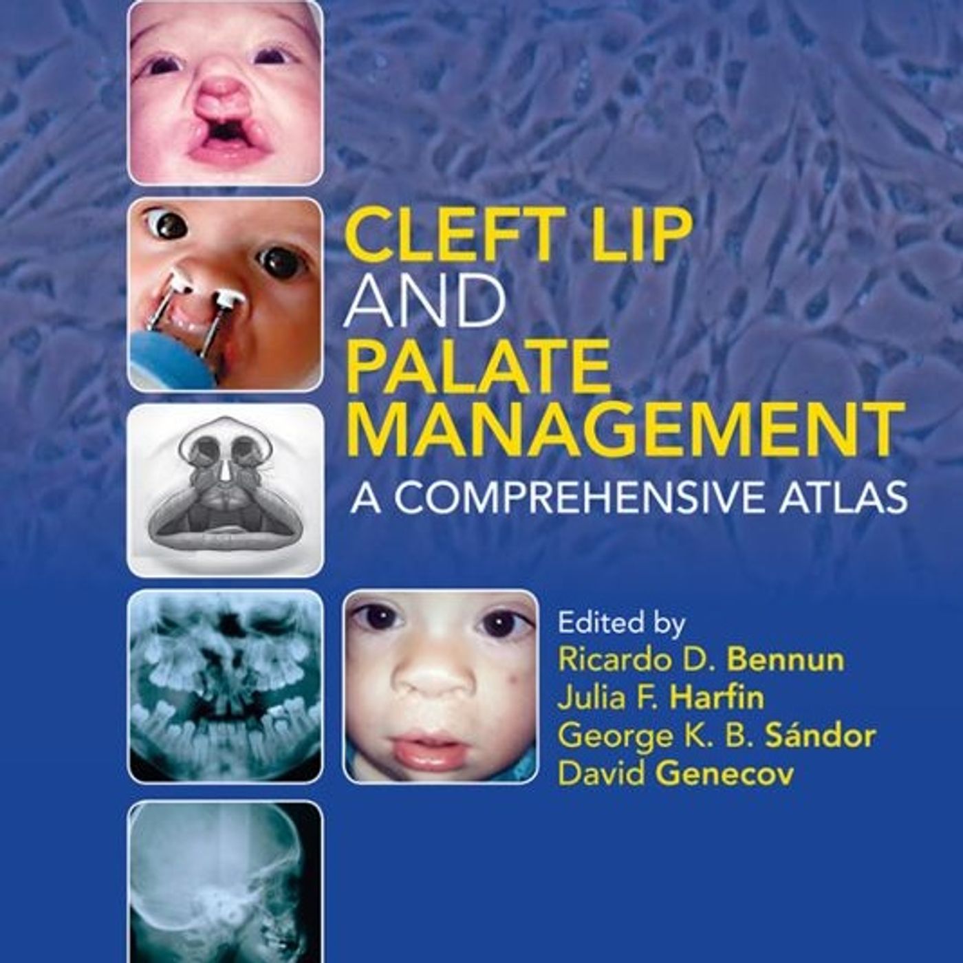 Cleft Lip and Palate Management: A Comprehensive Atlas