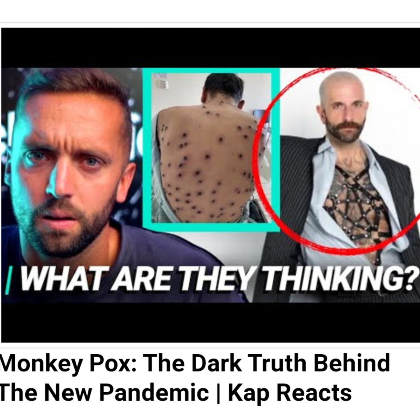 Monkey Pox: The Dark Truth Behind The New Pandemic | Kap Reacts episode artwork