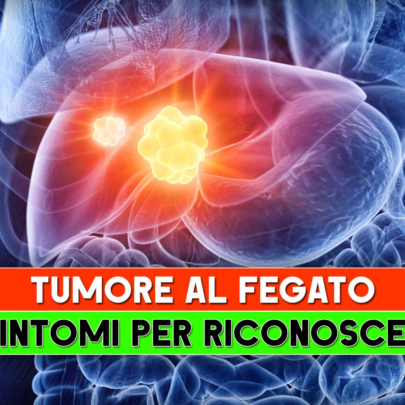 Tumore Al Fegato: I 5 Sintomi Per Riconoscerlo! episode artwork