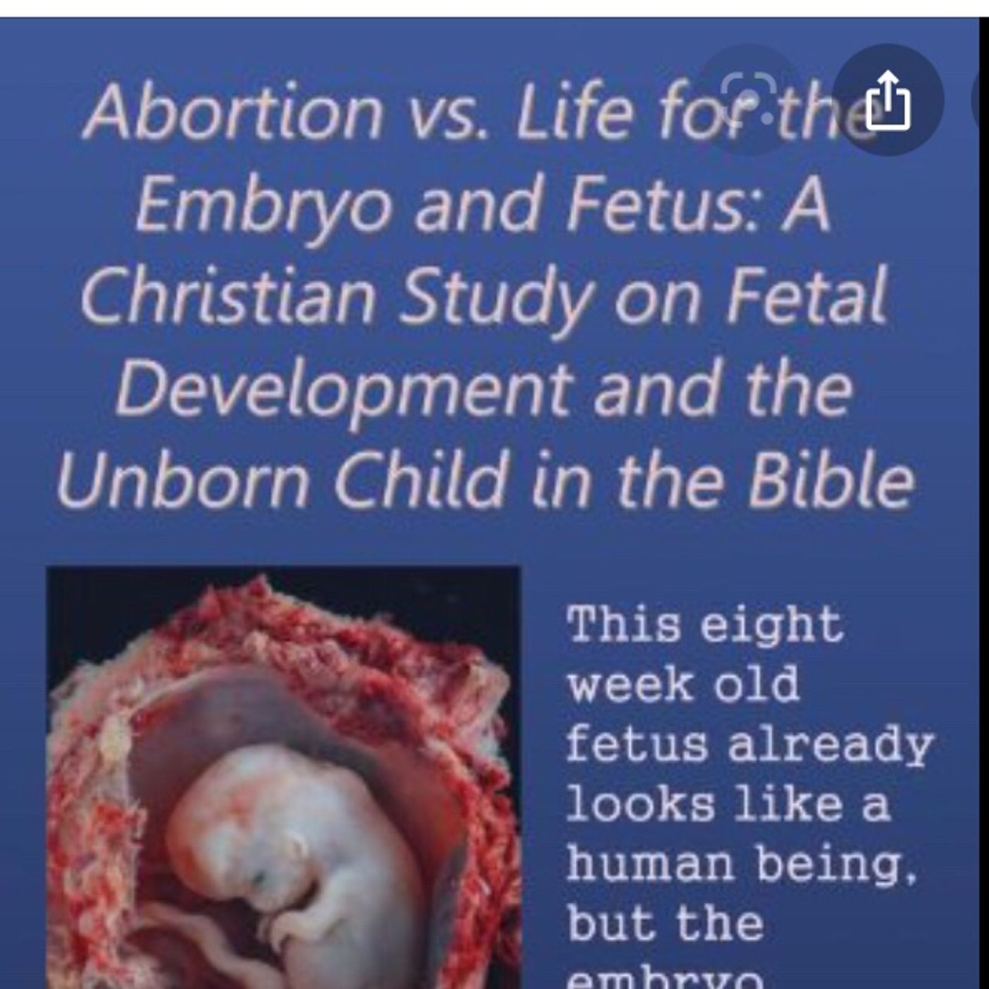 Johnson And Johnson’s Covid Vaccine Is Made From The Tissue of Aborted Fetuses episode artwork