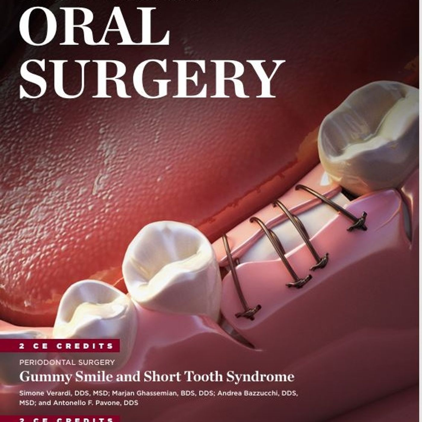 ORAL SURGERY