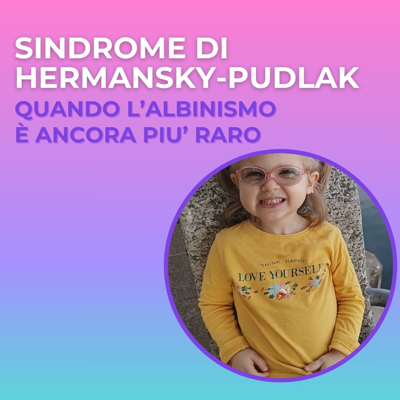 Nero su bianco  - storie di albinismo