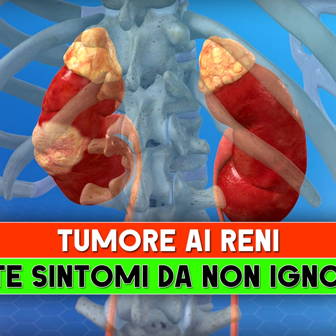 Tumore ai Reni: I Sette Sintomi Da Non Ignorare! episode artwork