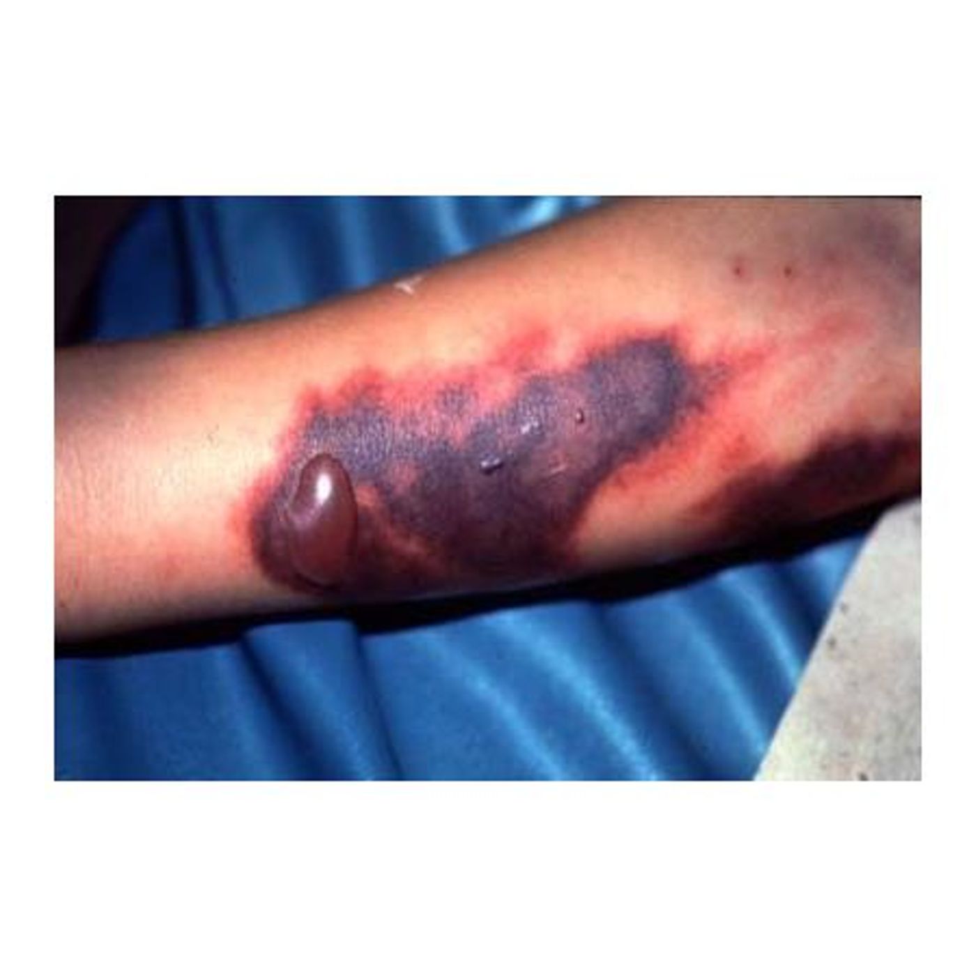 Survival Medicine Hour: SURVIVAL! the board game, Ebola, Mudslides