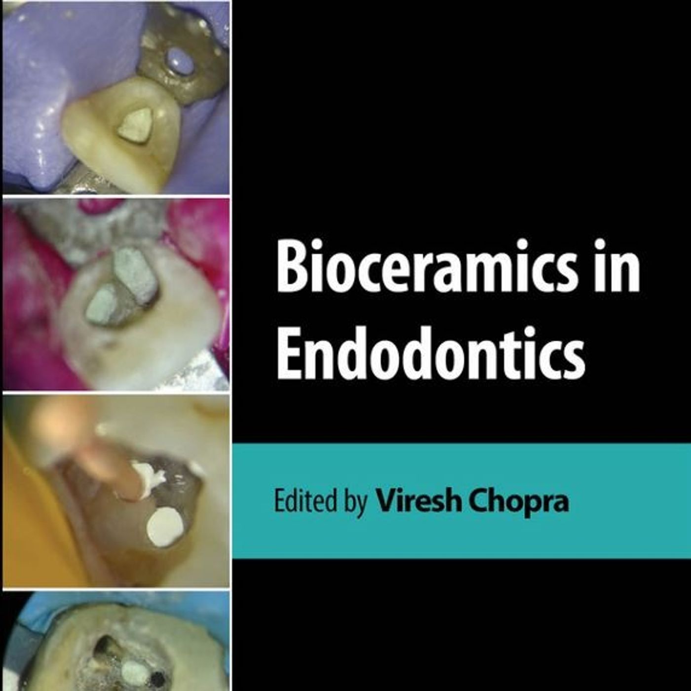 Bioceramics in Endodontics