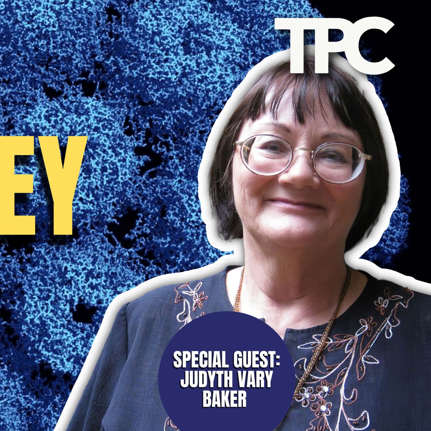 SV-40 Monkey Virus | Judyth Vary Baker (TPC #1,289)